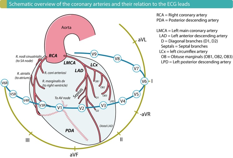 Det højre hjertekammer forsynes af den højre marginalarterie (r. marginalis dx), som udspringer fra den højre koronararterie (RCA). RCA forsyner også den inferiore venstre ventrikelvæg hos over 90 % af alle individer. Derfor vil en proksimal okklusion (i RCA), som afbryder blodtilførslen til højre ventrikel, også påvirke den nedre væg i venstre ventrikel i 90 % af tilfældene.