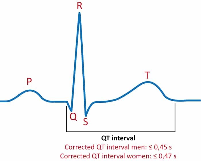 Figur 1. QT-intervallet på EKG'et.