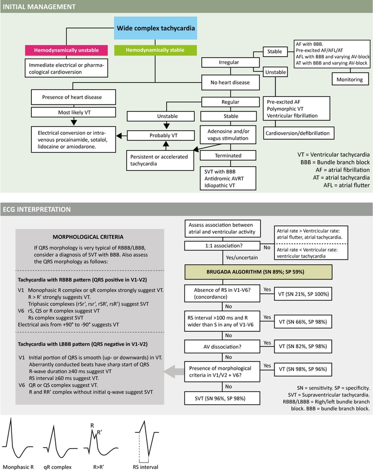 Figur 5. Behandling og EKG-diagnose af bredkomplekse takykardier.