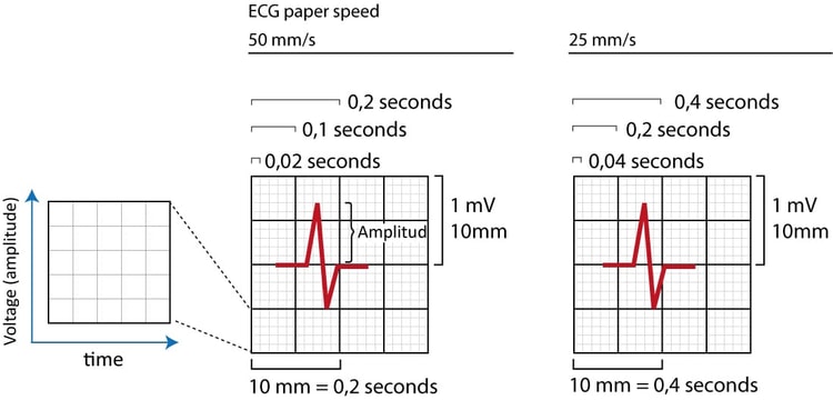 Figur 1. EKG-gitteret. X-aksen repræsenterer tid, og y-aksen repræsenterer amplituden af de elektriske signaler, der genereres i myokardiet. Det samme EKG-gitter bruges til børn og voksne patienter.