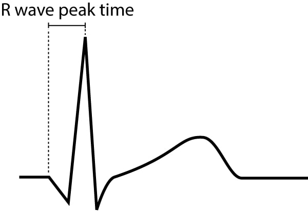 Figur 9. R-bølgens peak-tid er defineret som tidsintervallet mellem QRS-kompleksets begyndelse og R-bølgens apex.