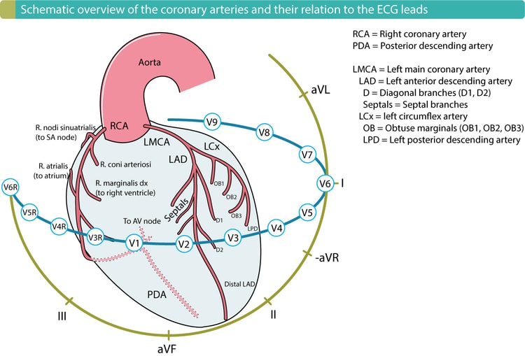 Lokalisering af koronararterier, myokardium og EKG-afledninger