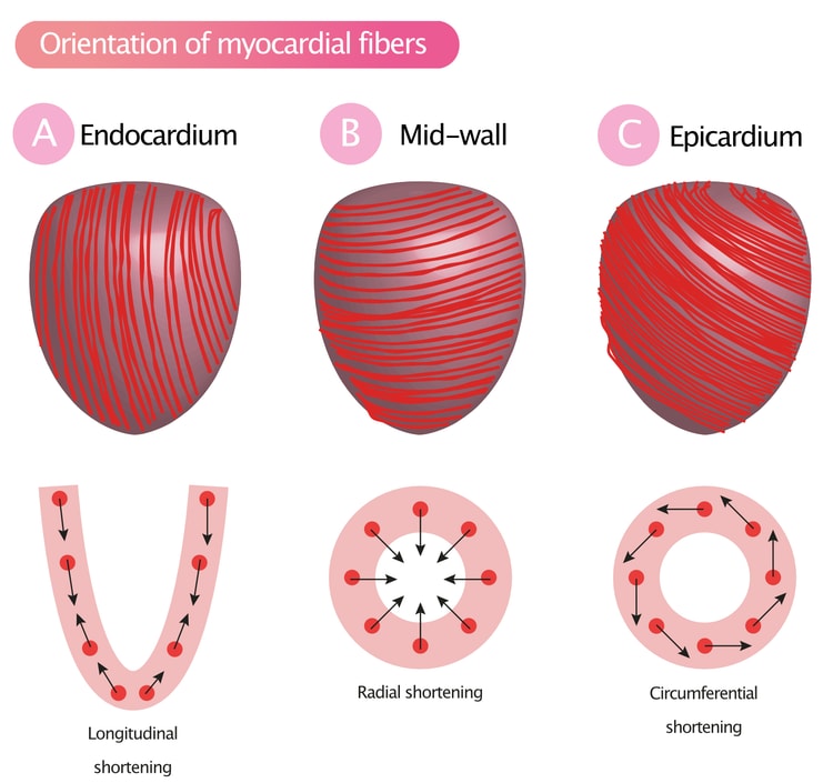 Figur 2A-2C. Orienteringen af myokardiets muskelfibre resulterer i longitudinal, radial og perifer forkortelse (sammentrækning).