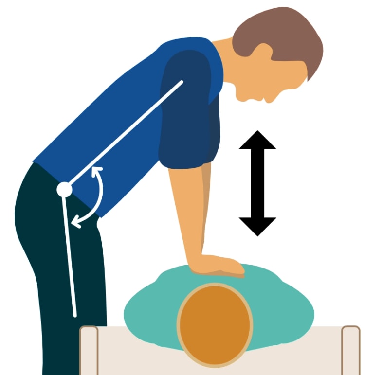 Figur 2. Manuelle brystkompressioner ved ACLS.