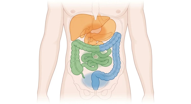 Abdominalorganer set forfra, farvekodet efter embryologisk oprindelse, med tilsvarende smertezoner i epigastriet, periumbilikalt og i hypogastriet.