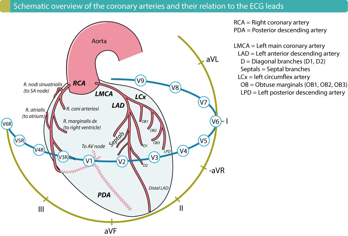 Det højre hjertekammer forsynes af den højre marginalarterie (r. marginalis dx), som udspringer fra den højre koronararterie (RCA). RCA forsyner også den inferiore venstre ventrikelvæg hos over 90 % af alle individer. Derfor vil en proksimal okklusion (i RCA), som afbryder blodtilførslen til højre ventrikel, også påvirke den nedre væg i venstre ventrikel i 90 % af tilfældene.