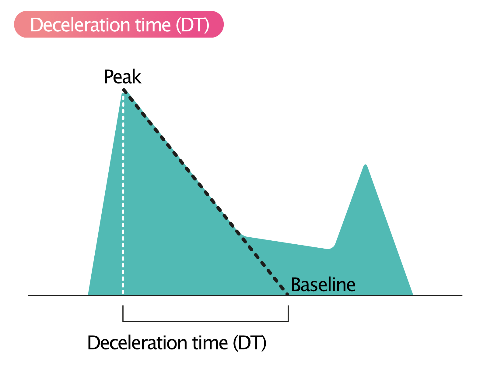 Figur 2. Decelerationstid (DT).